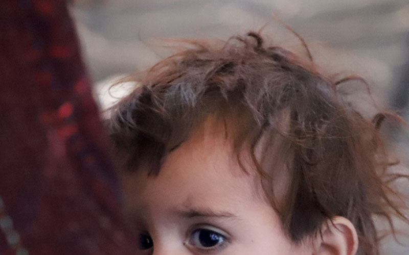Photo recadrée d’un jeune enfant, ne montrant que ses yeux et ses cheveux.