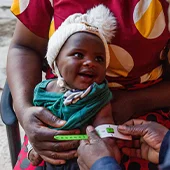 Un membre du personnel de World Vision mesure le bras d’un bébé lors d’un examen médical.
