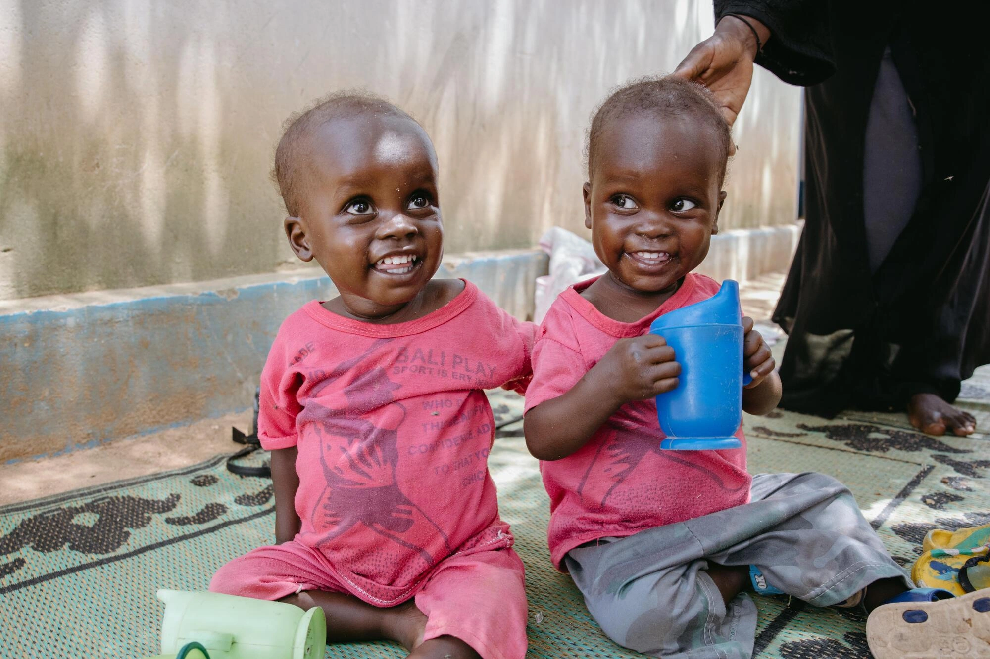 Sudan-Hunger-twins-malnutrition