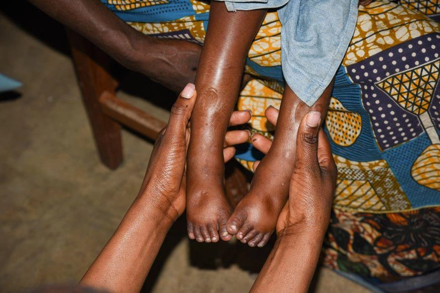 DRC-Hunger-Hortense-feet