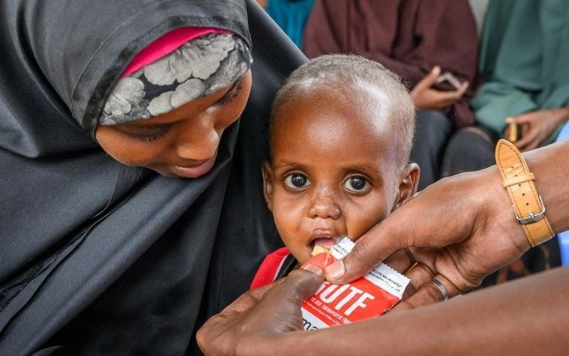 Un nourrisson reçoit des aliments thérapeutiques prêts à consommer (RUTF) de la part du personnel de World Vision au Centre de santé maternelle et infantile de Darussalam, à Baidoa, en Somalie.