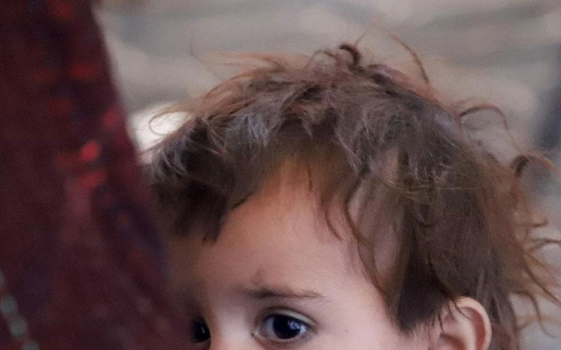 Photo recadrée d’un jeune enfant, ne montrant que ses yeux et ses cheveux.