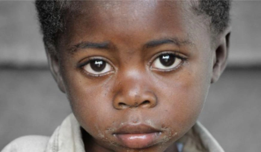A young boy with soulful eyes looks straight at you.
