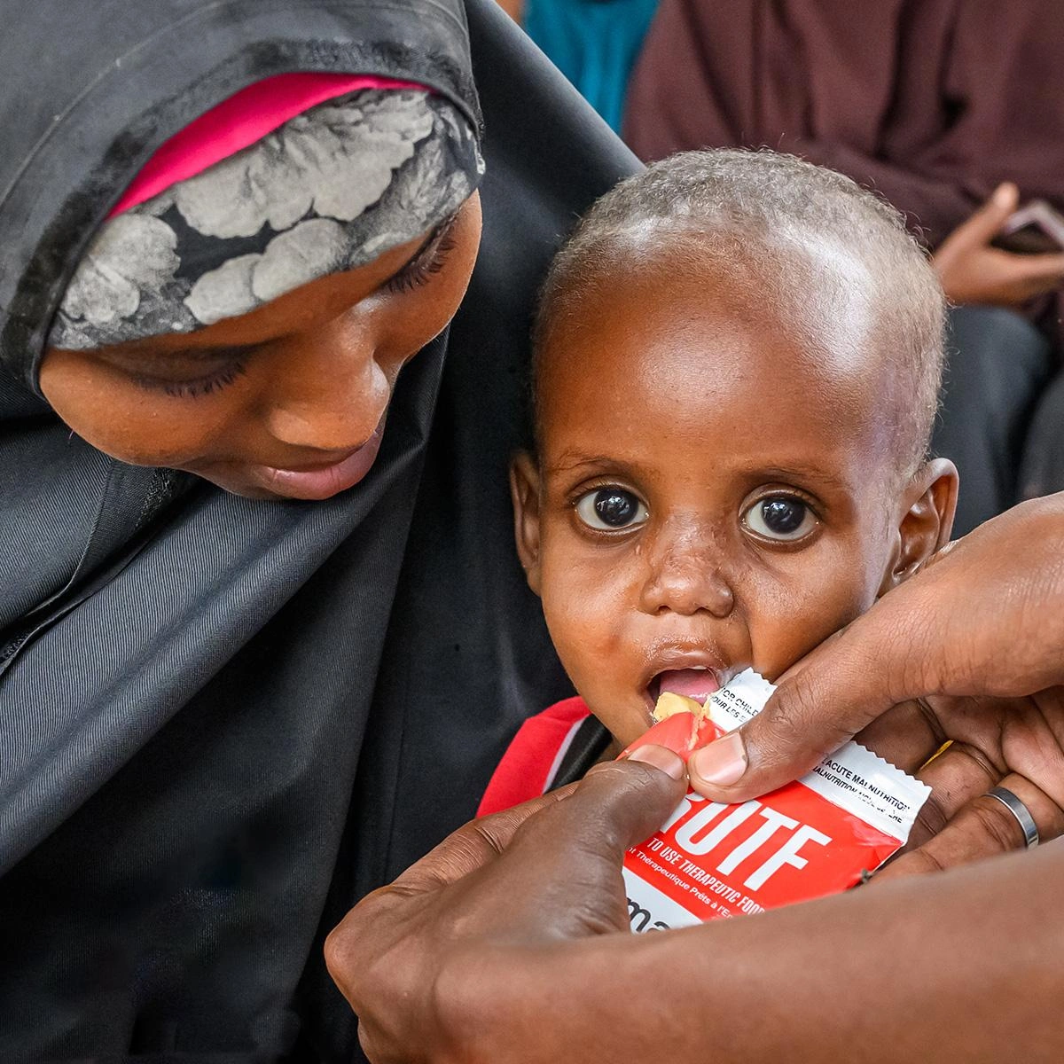 A malnourished child being fed therapeutic food.